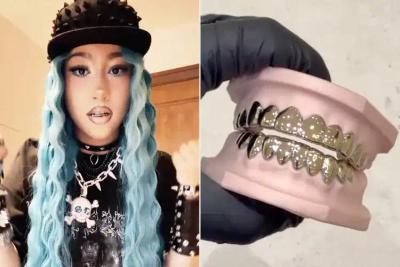 North West Flashes New Grills in Viral TikTok Return
